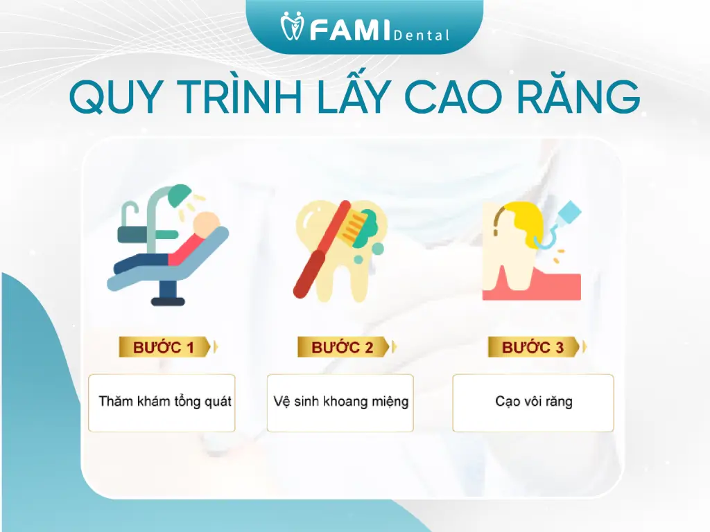 Quy trình lấy cao răng