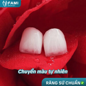 Tieu Chuan 3