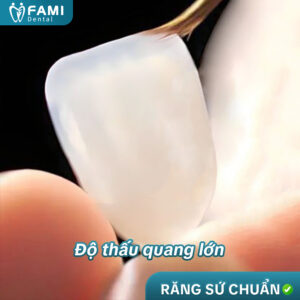 Tieu Chuan 4
