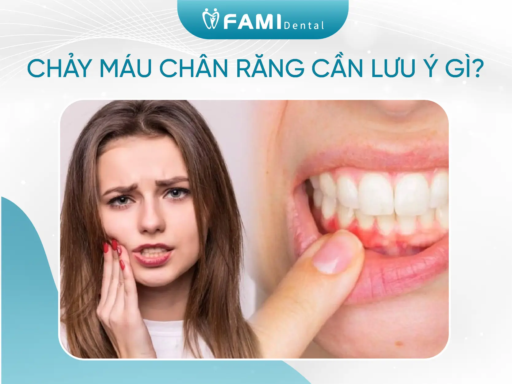 chảy máu chân răng cần lưu ý gì