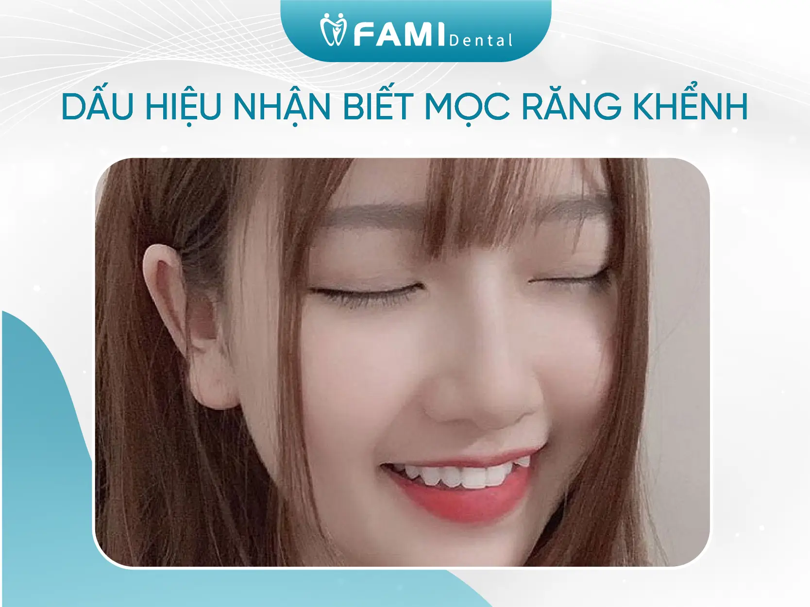 Răng khểnh ảnh hưởng như thế nào đến tướng số và phong thủy? 1 dấu hiệu nhận biết mọc răng khểnh