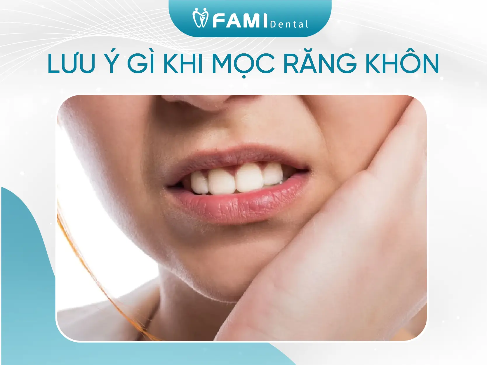 Mọc răng khôn và 5 dấu hiệu bạn cần biết 1 lưu ý khi mọc răng khôn