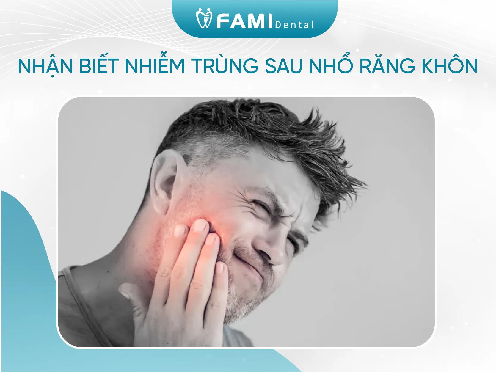 8 dấu hiệu bạn cần biết về nhiễm trùng sau khi nhổ răng khôn 1 nhận biết nhiễm trùng sau khi nhổ răng khôn