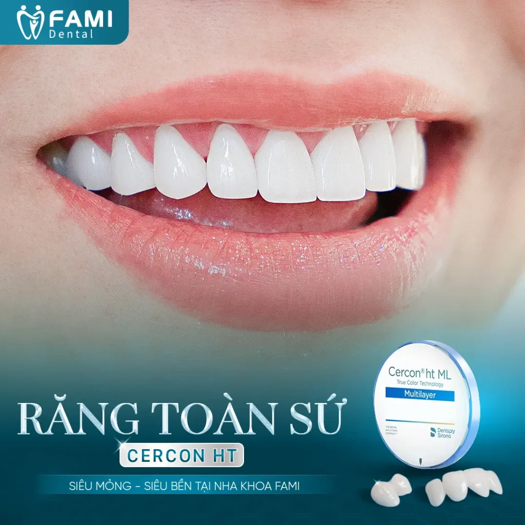 Mau rang su cercon