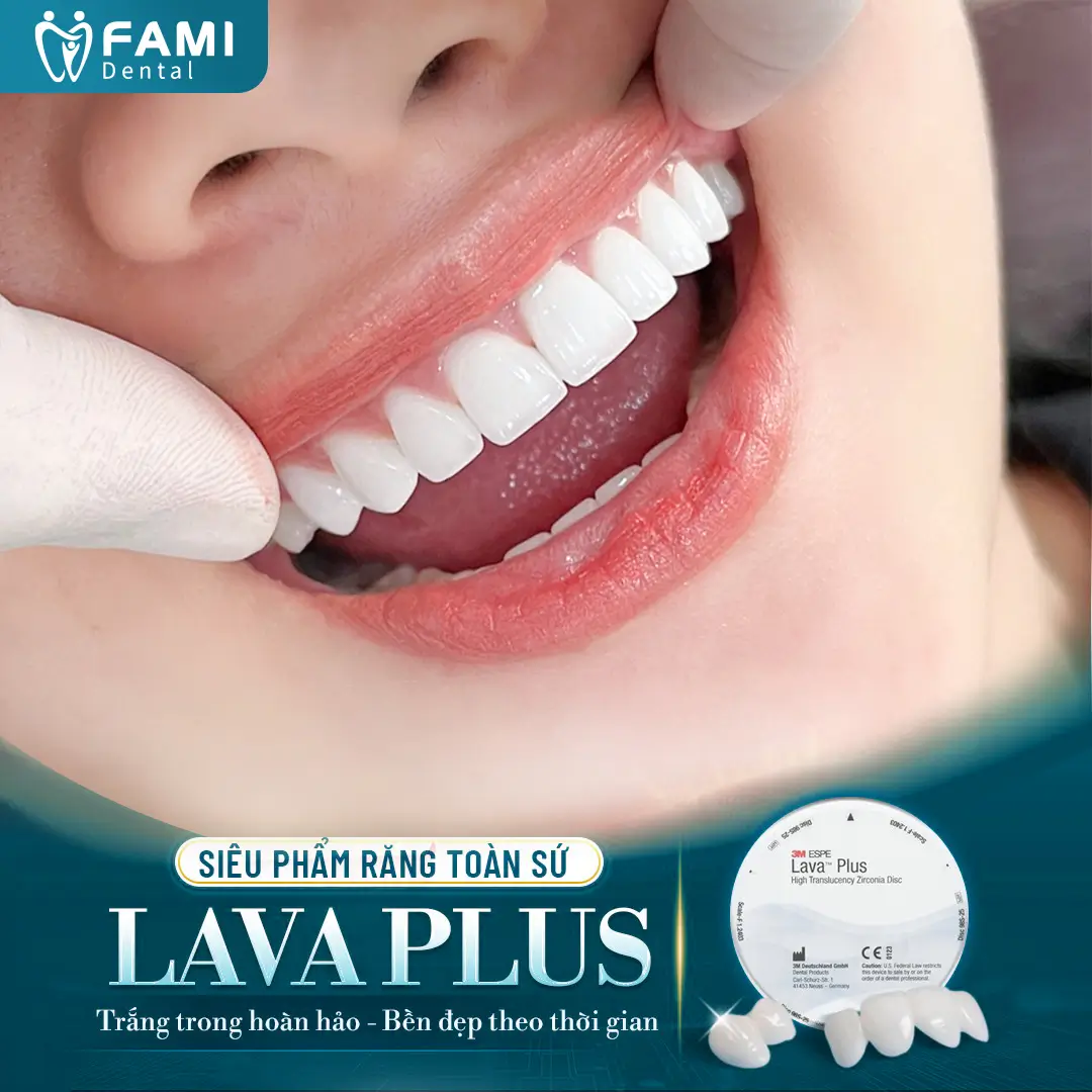 Mẫu răng sứ lava