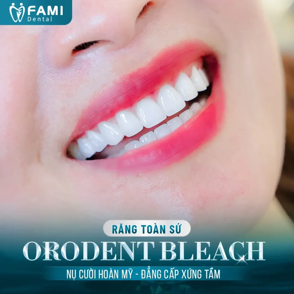 răng sứ orodent