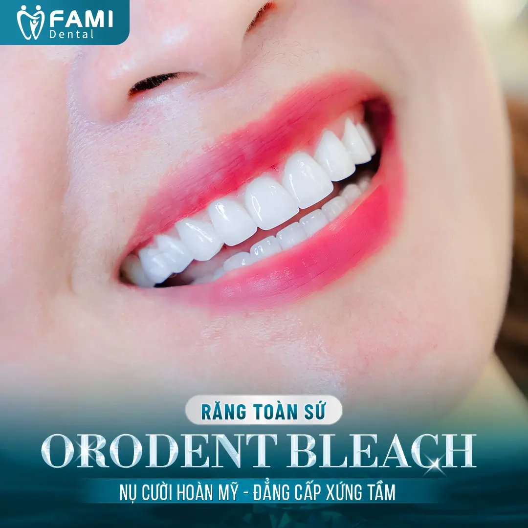 răng sứ orodent