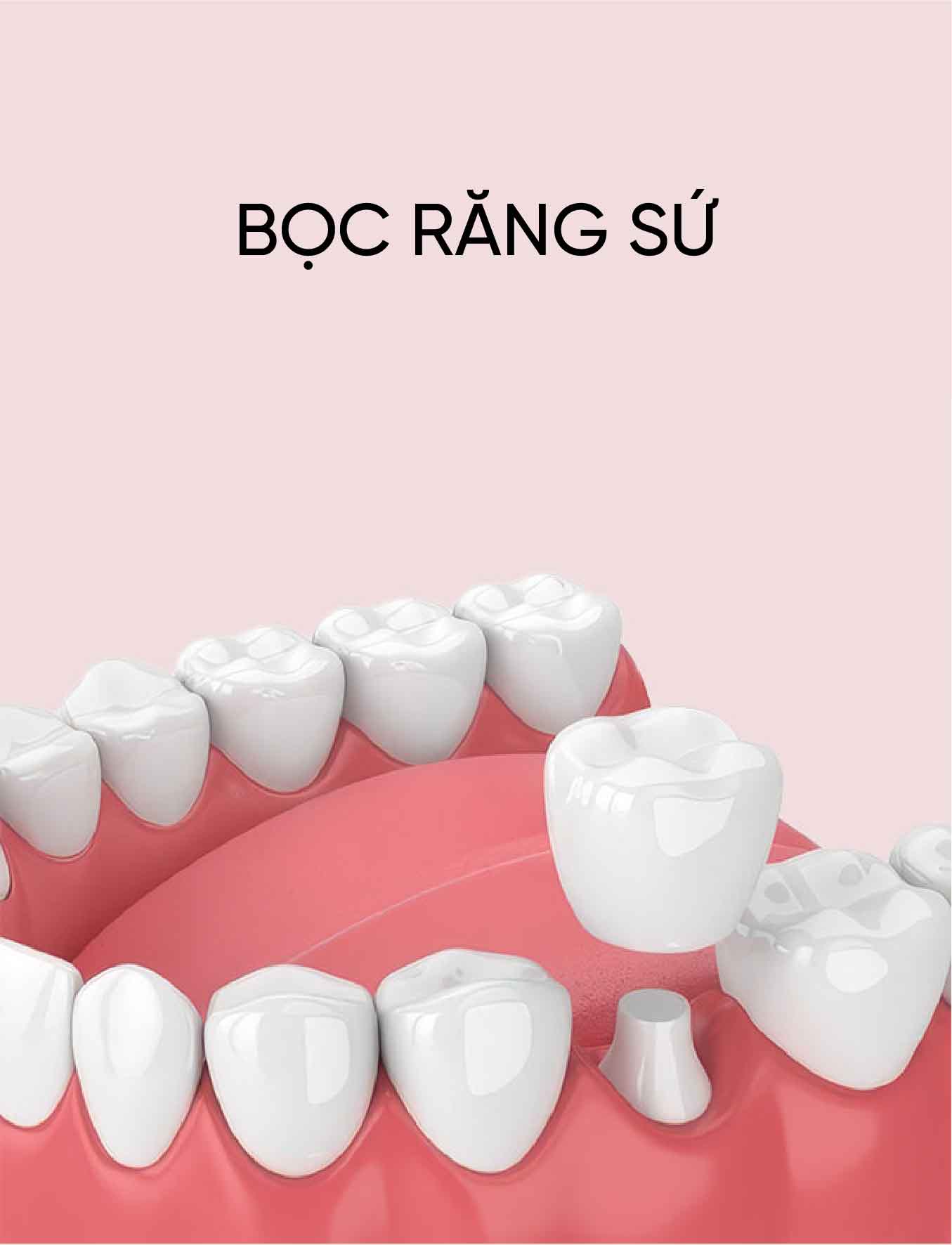 dich vu boc rang su