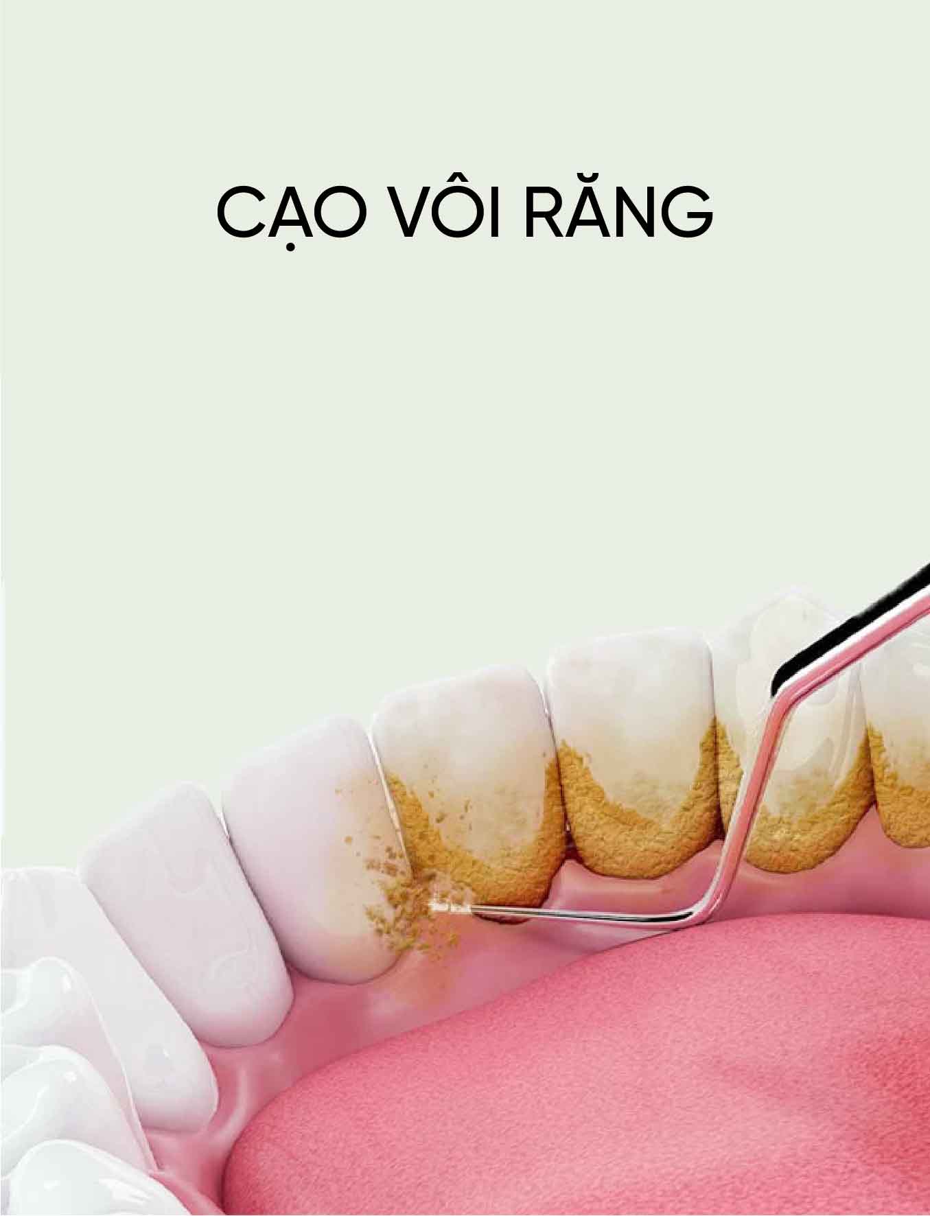 dich vu cao voi rang