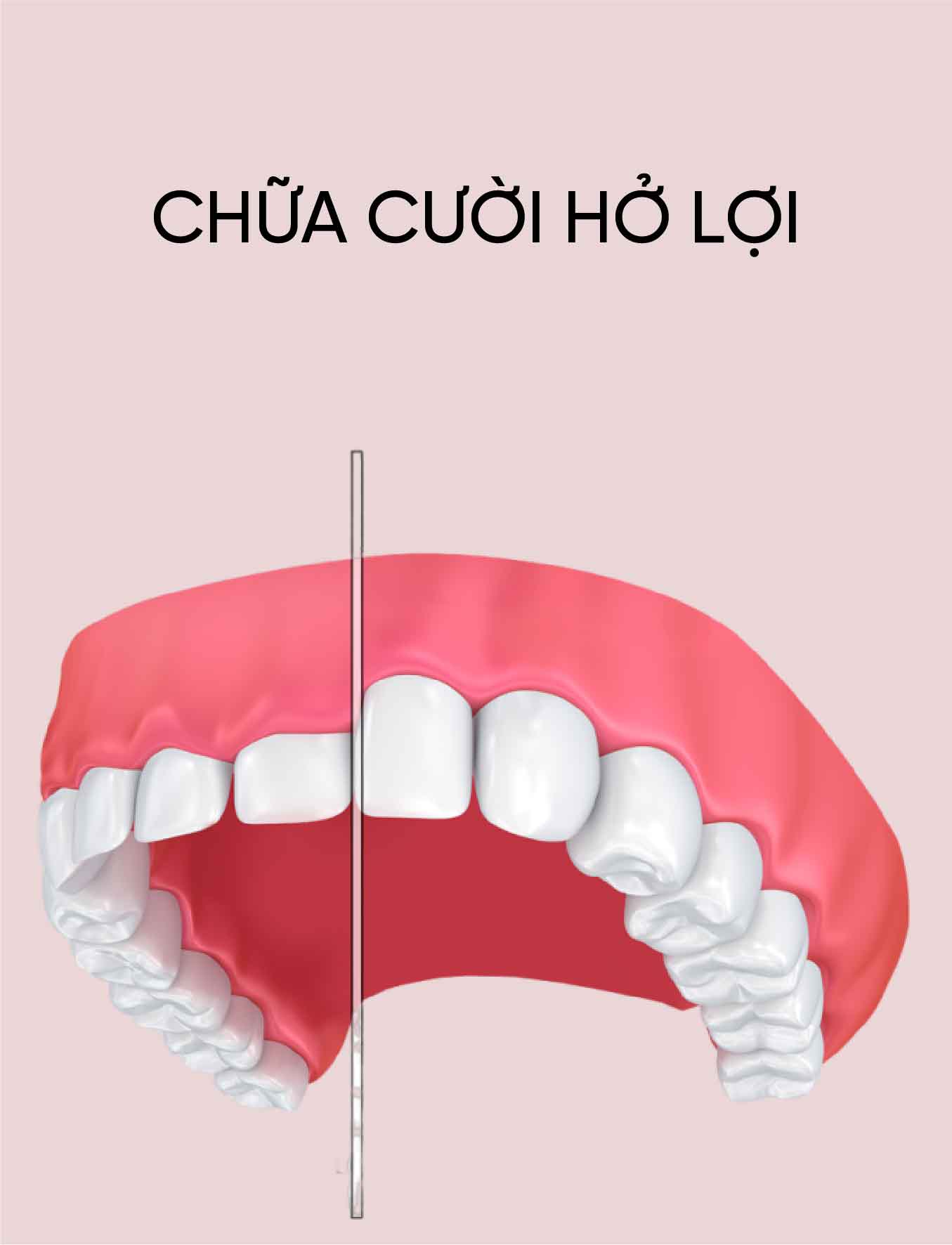 dich vu chua cuoi ho loi