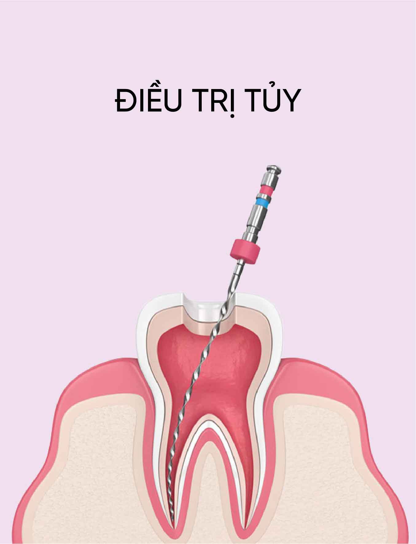 dich vu dieu tri tuy