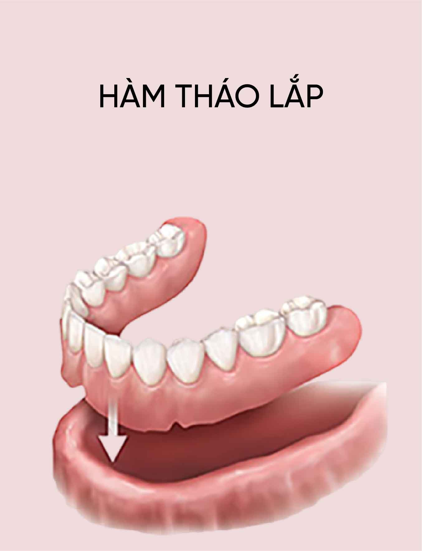 dich vu ham thao lap