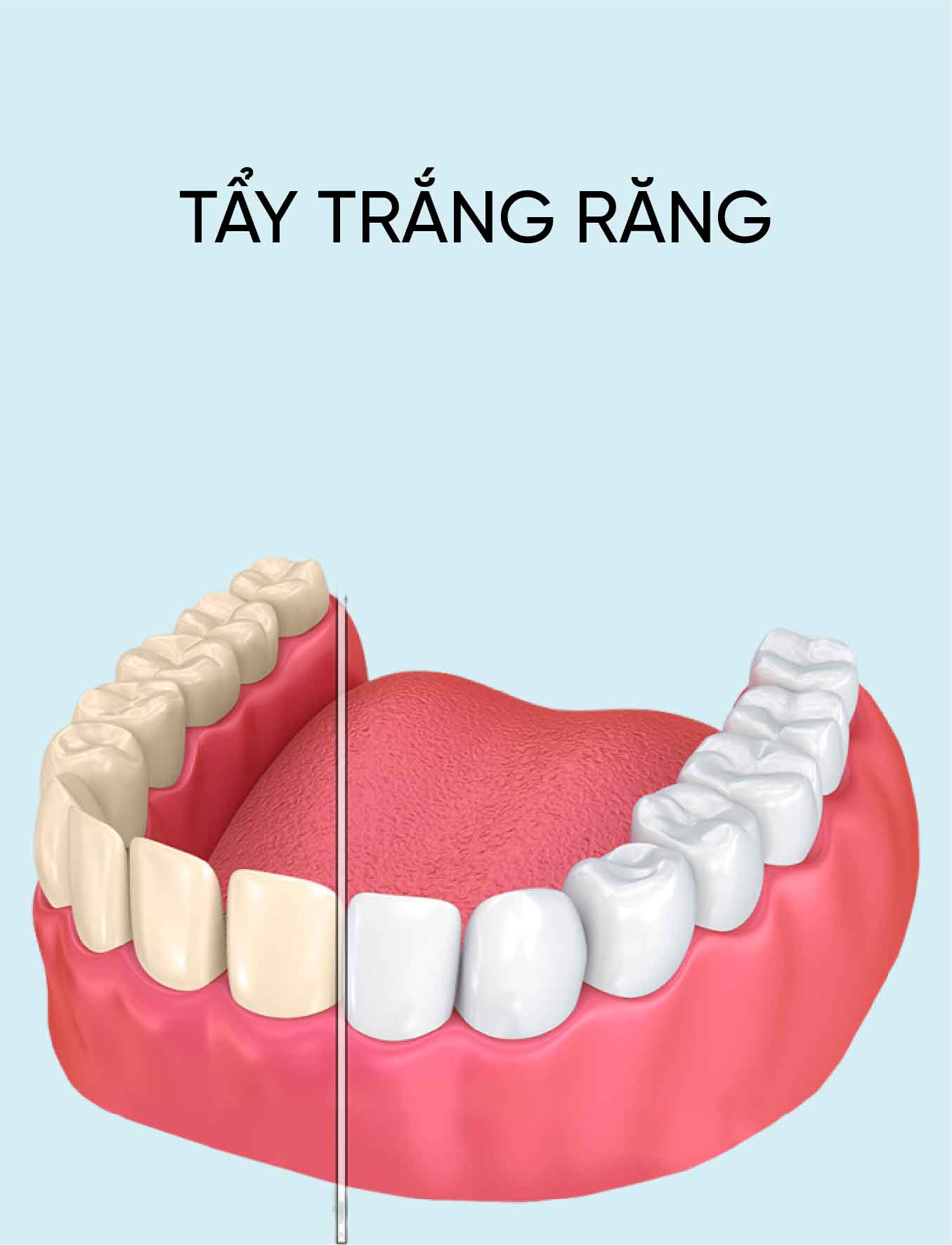 dich vu tay trang rang
