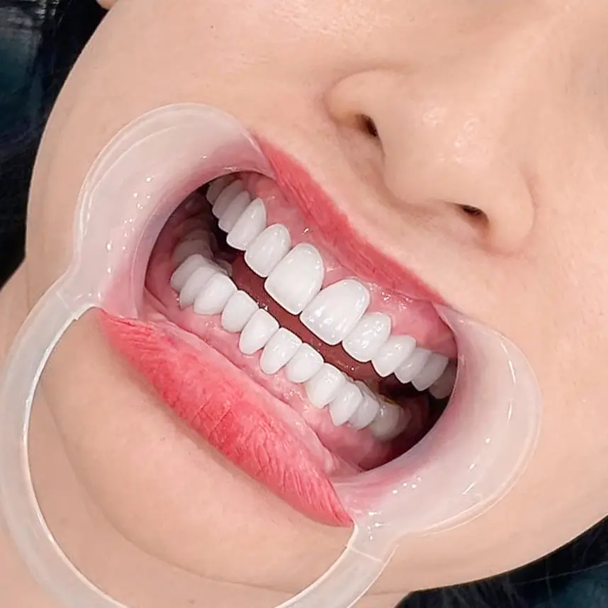 khách hàng răng sứ ddbio