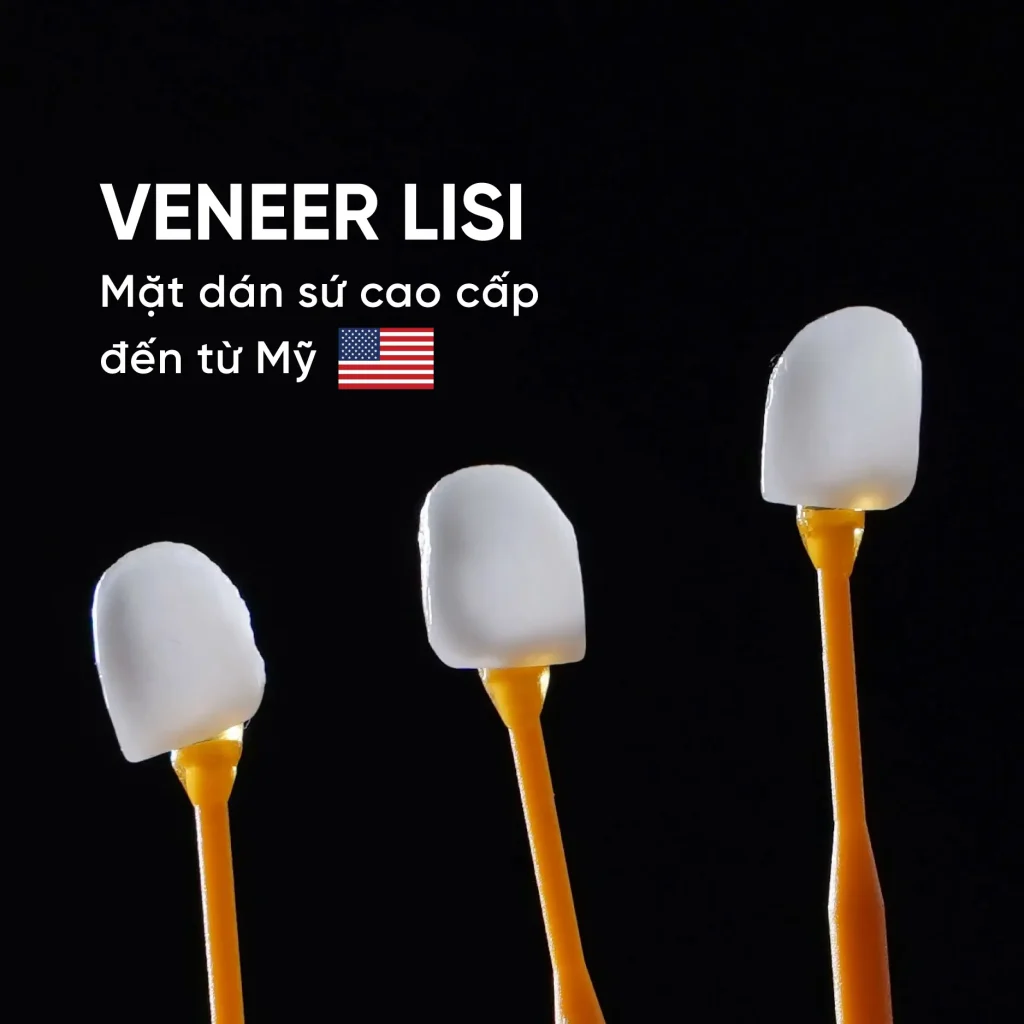 mặt dán sứ lisi