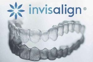 nieng rang trong suot invisalign 02