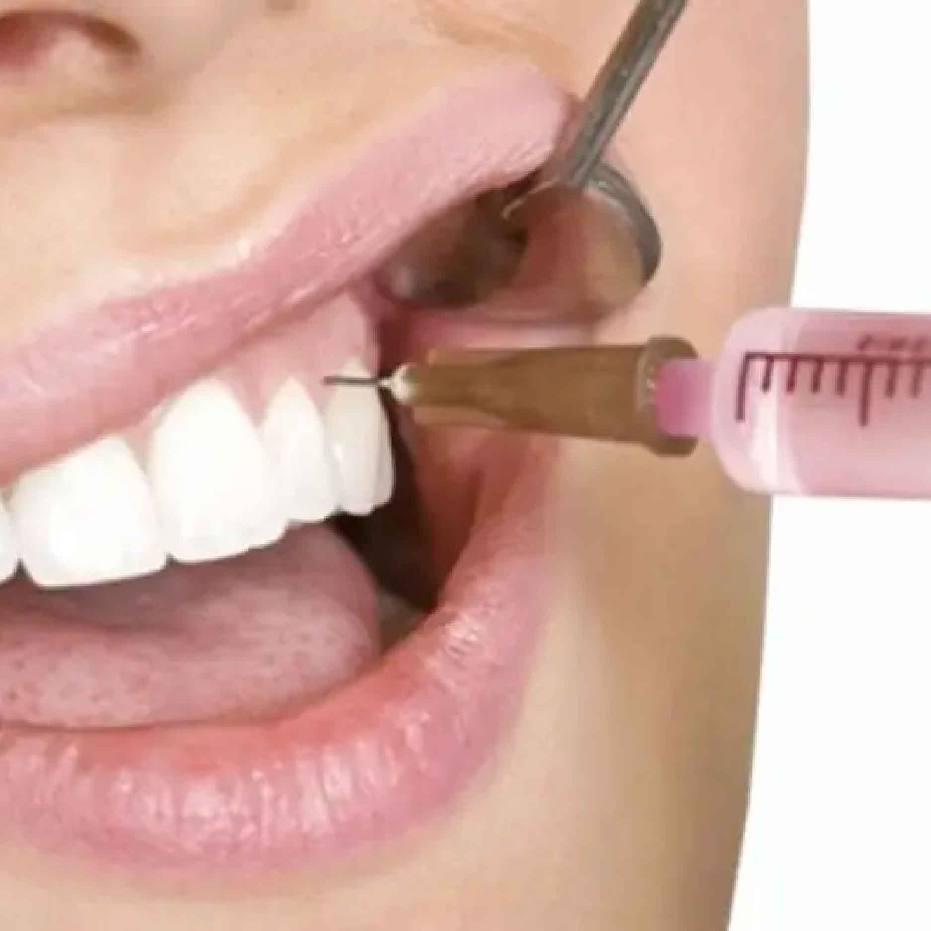 tiem-botox-filler-chua-cuoi-ho-loi-01 tiem botox filler chua cuoi ho loi 01