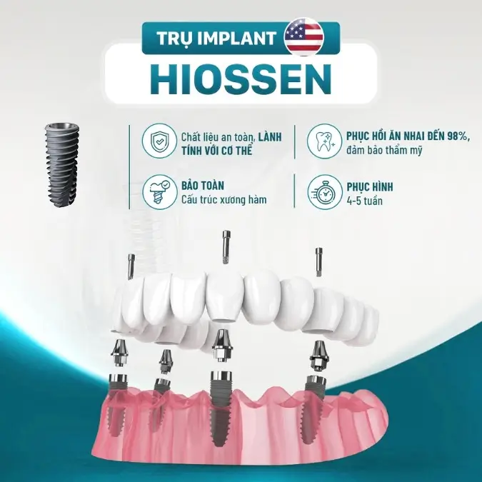trụ hiossen ưu điểm (1) trụ hiossen ưu điểm