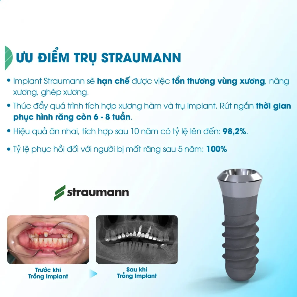 ưu điểm implant Straumann